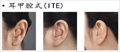 耳甲腔式效果圖